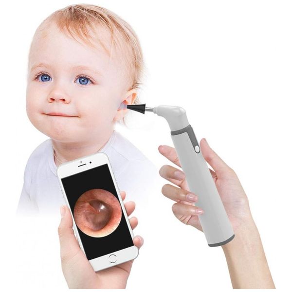 Otoscópio Sem Fio com Câmera de Orelha HD 720P, 6 Luzes LED e Ferramenta de Remoção de Cera, Compatível com iPhone e Android, ScopeAround, Branco