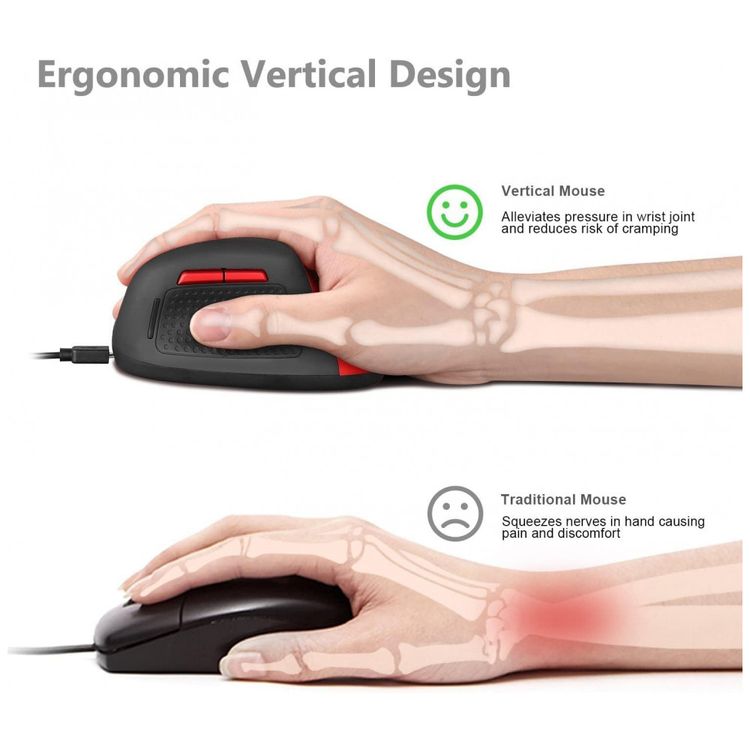 Mouse-Ergonomico-Vertical-Optico-sem-Fio-Reduz-a-Tensao-do-foto-2