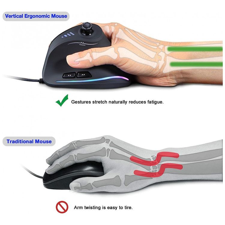 Mouse-para-Jogos-Ergonomico-Vertical-Optico-com-Fio-Reduz-a-foto-2