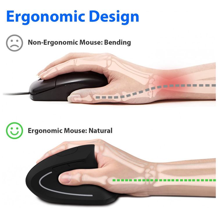 Mouse-Ergonomico-Vertical-sem-Fio-Reduz-a-Tensao-do-Pulso-foto-1