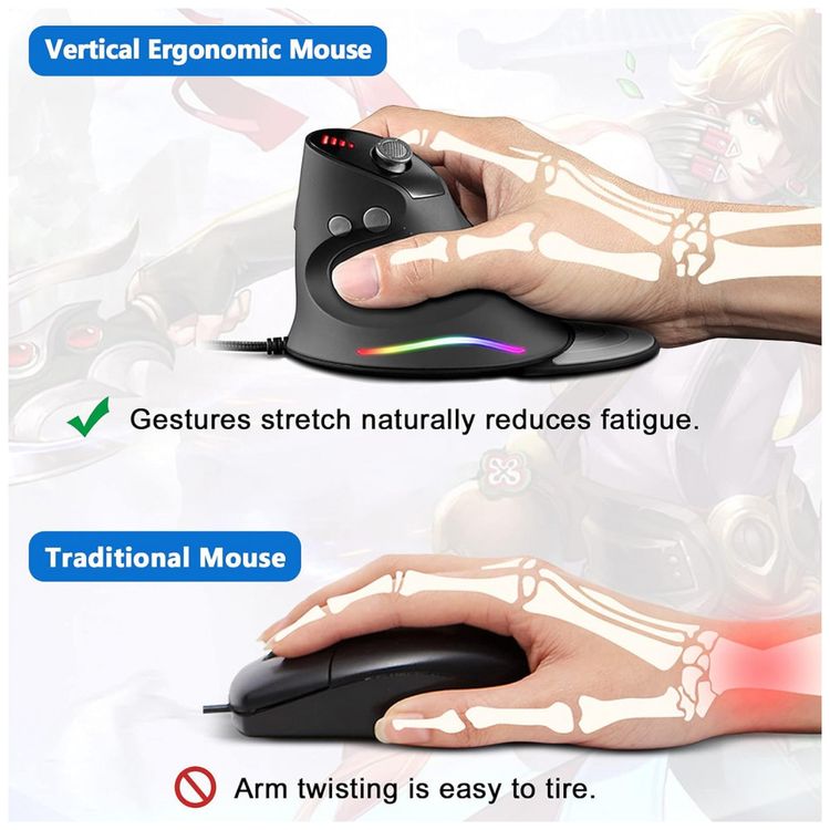 Mouse-para-Jogos-Ergonomico-Vertical-Optico-com-Fio-Reduz-a-foto-4