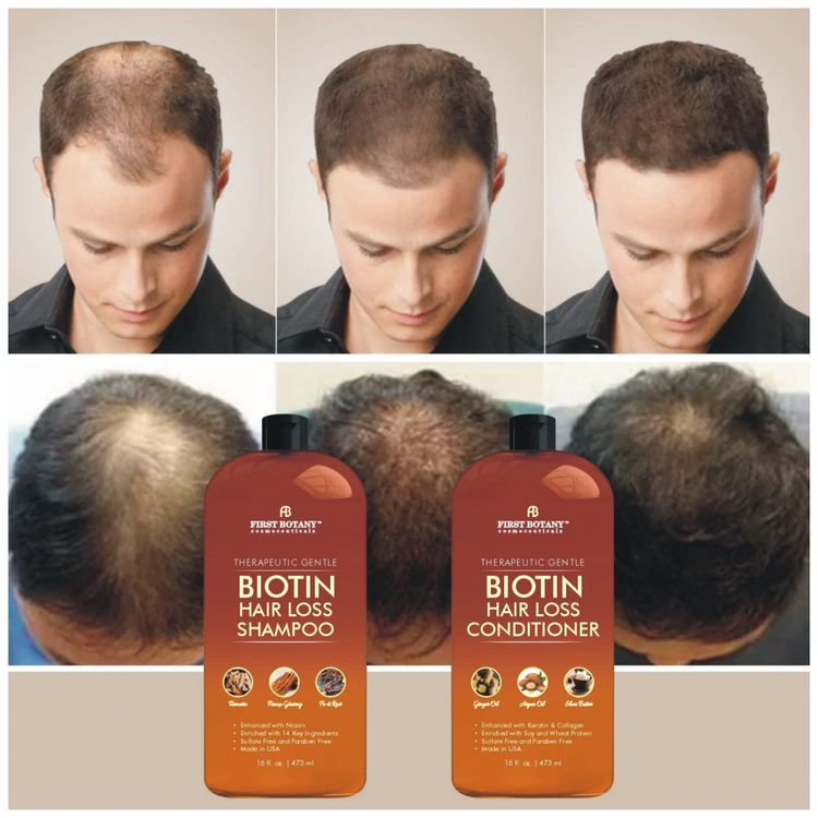 Shampoo-e-Condicionador-473-ml-de-Biotina-Anti-Queda-de-foto-3