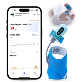 Monitor-de-Oxigenio-para-Bebes-Sono-com-Bluetooth-e-APP-0-foto-0