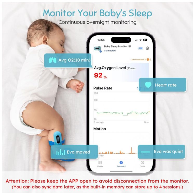 Monitor-de-Oxigenio-para-Bebes-Sono-com-Bluetooth-e-APP-0-foto-1