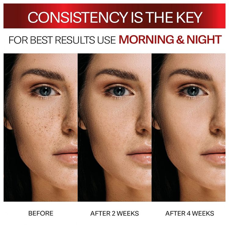 Anti-Idade-Facial-com-Acido-Hialuronico-e-Vitamina-AE-50-foto-3