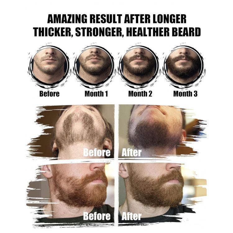 Kit-para-Barba-Profissional-Portatil-com-Cera-e-Pente-7-Imagem-1